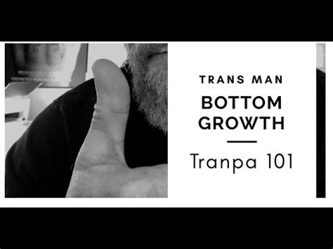 bottom growth trans|Bottom Growth 101: What is Bottom Growth on。